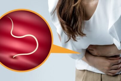 Foods That Kill Parasites in Humans