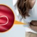 Foods That Kill Parasites in Humans
